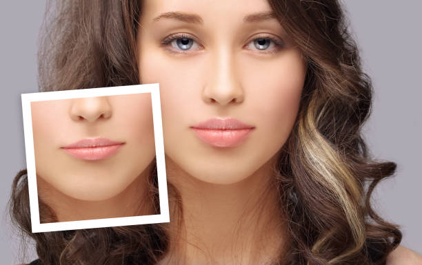 Are At-Home Lip Fillers Safe?
