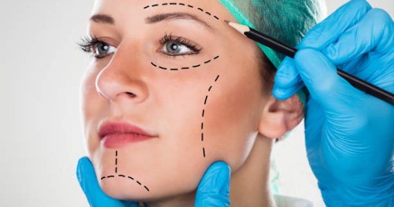 How to Choose thee Right Liposuction Surgeon